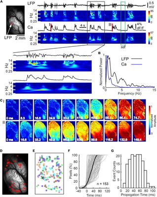 Isoflurane-Induced Burst Suppression Is a Thalamus-Modulated, Focal-Onset Rhythm With Persistent Local Asynchrony and Variable Propagation Patterns in Rats